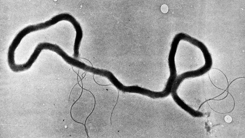 梅毒苍白螺旋体图片